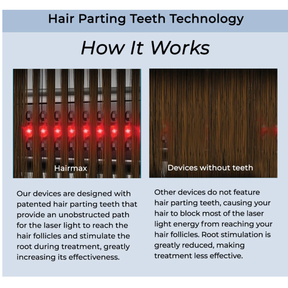 HairMax ACTONIS™ 18 DUAL ACTION LASERCOMB - Lāzerķemme (Actduo18)