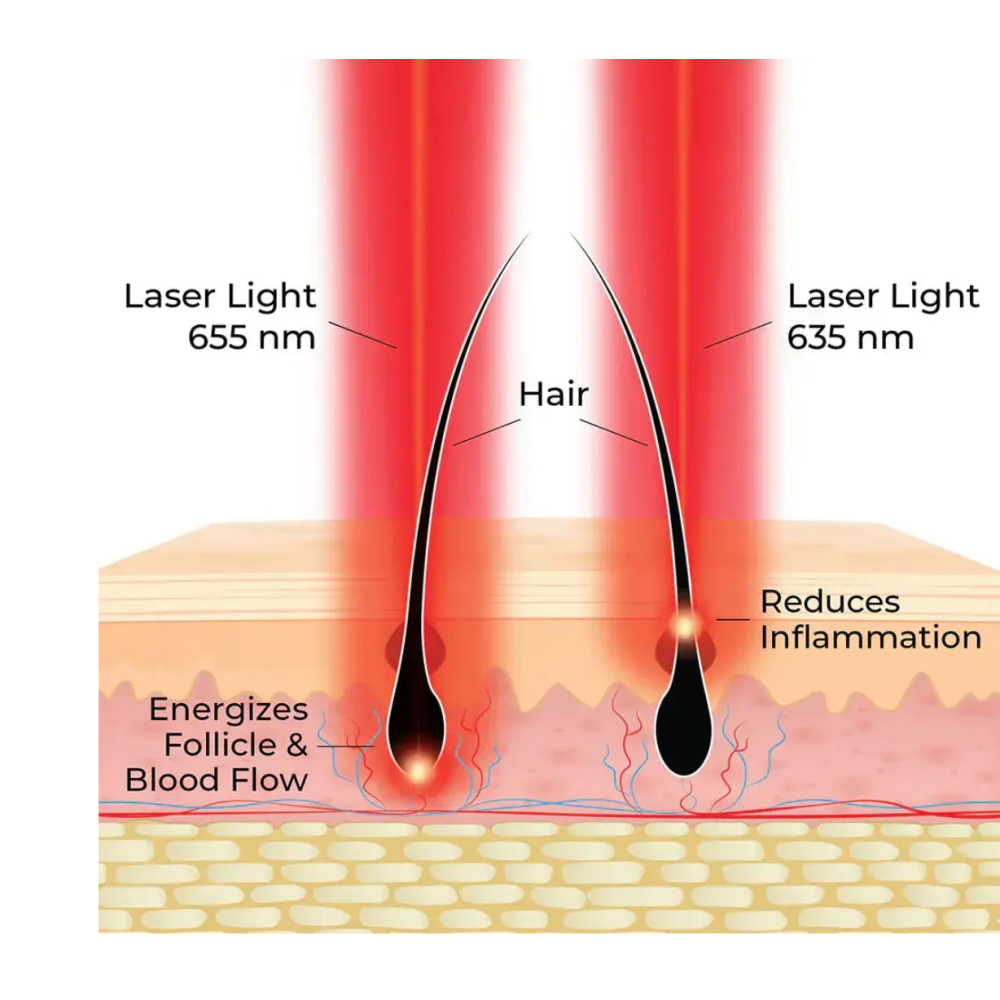HairMax ACTONIS™ 18 DUAL ACTION LASERCOMB - Lāzerķemme (Actduo18)