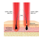 HairMax ACTONIS™ 18 DUAL ACTION LASERCOMB - Lāzerķemme (Actduo18)