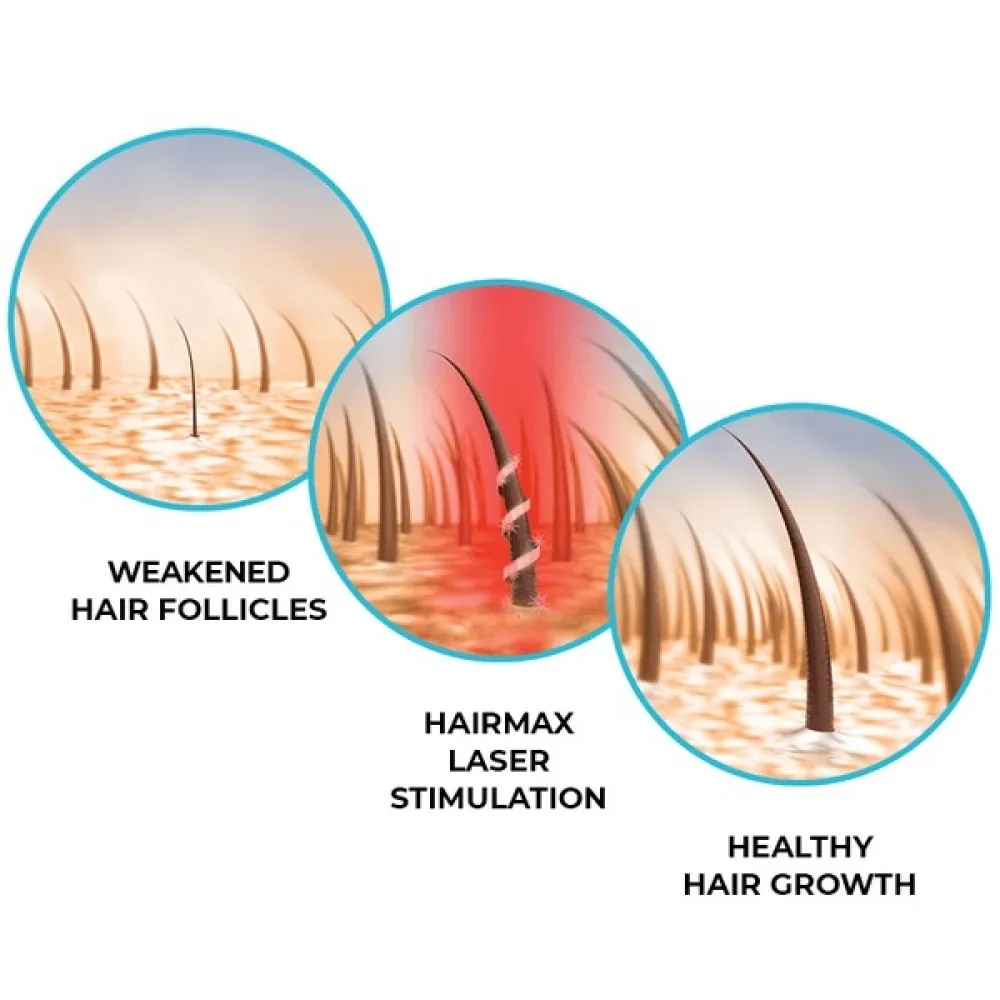 HairMax LaserBand 41 - ComfortFlex lāzerķemme-stīpa
