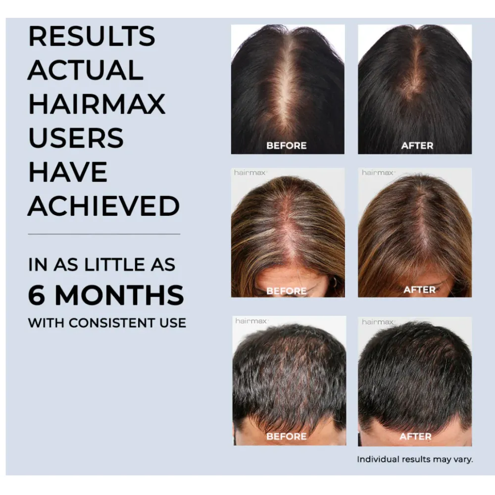 HairMax ACTONIS™ 18 DUAL ACTION LASERCOMB - Lāzerķemme