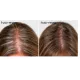 HairMax LaserBand 82 - ComfortFlex lāzerķemme-stīpa
